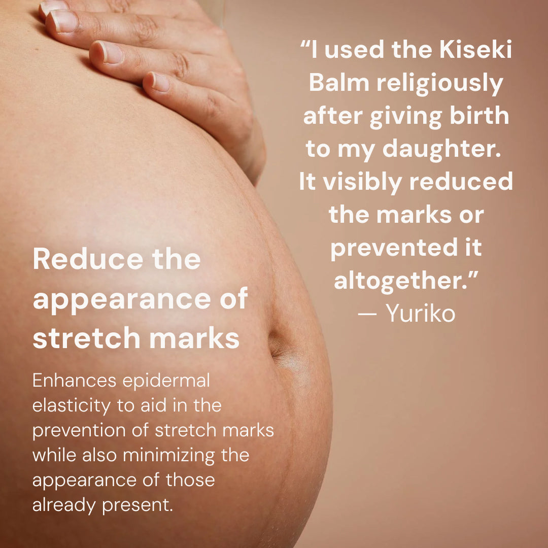 Kiseki Balm